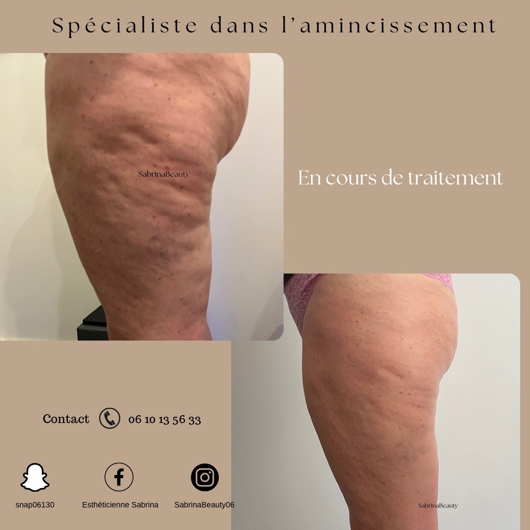 D7204F1E-8A93-4693-80A2-830DD90D92C2AAprès