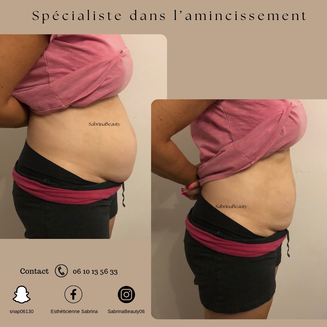 DB16AF0C-D999-4525-B314-B3EA302F7FEF